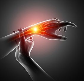 LRTI (Ligament Reconstruction and Tendon Interposition) for Thumb CMC Arthritis
